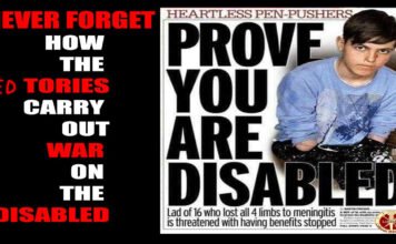 The Cruel Hand of the Red Tories: Labour’s Betrayal of Britain’s Most Vulnerable Boy with no arms and legs told he must prove he is disabled or his benefits will be stopped